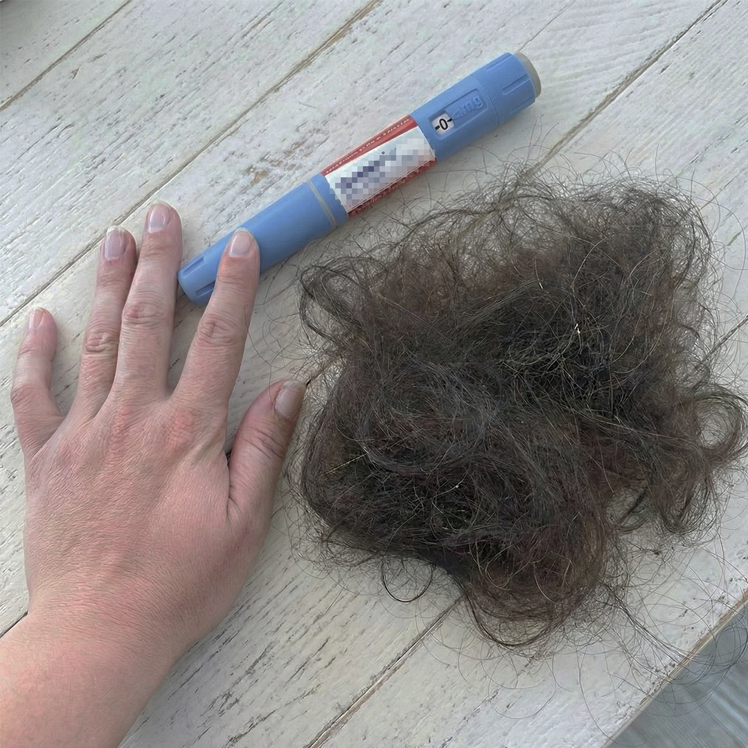 Hair loss in shower drain